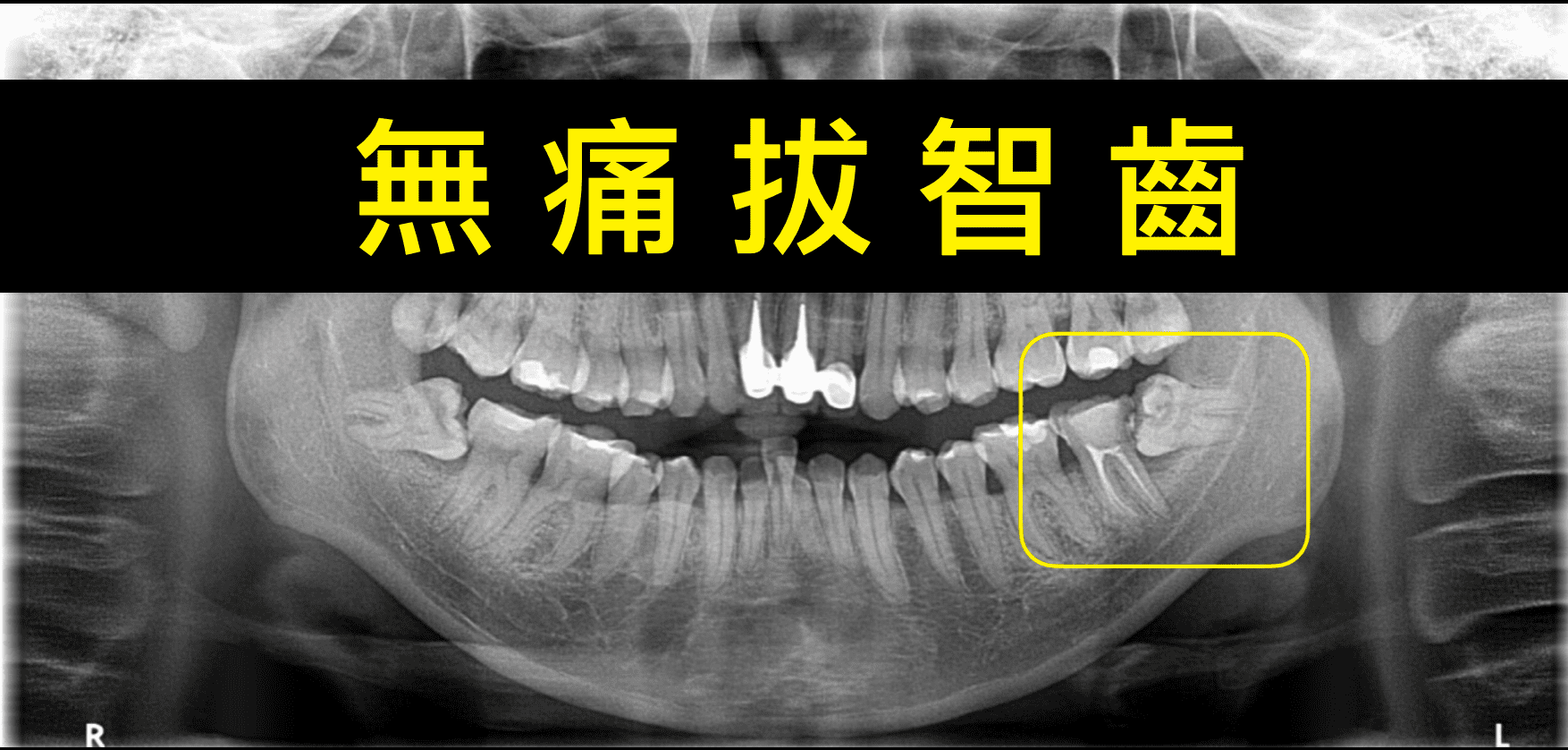 截圖 2024-01-01 上午11.39.48